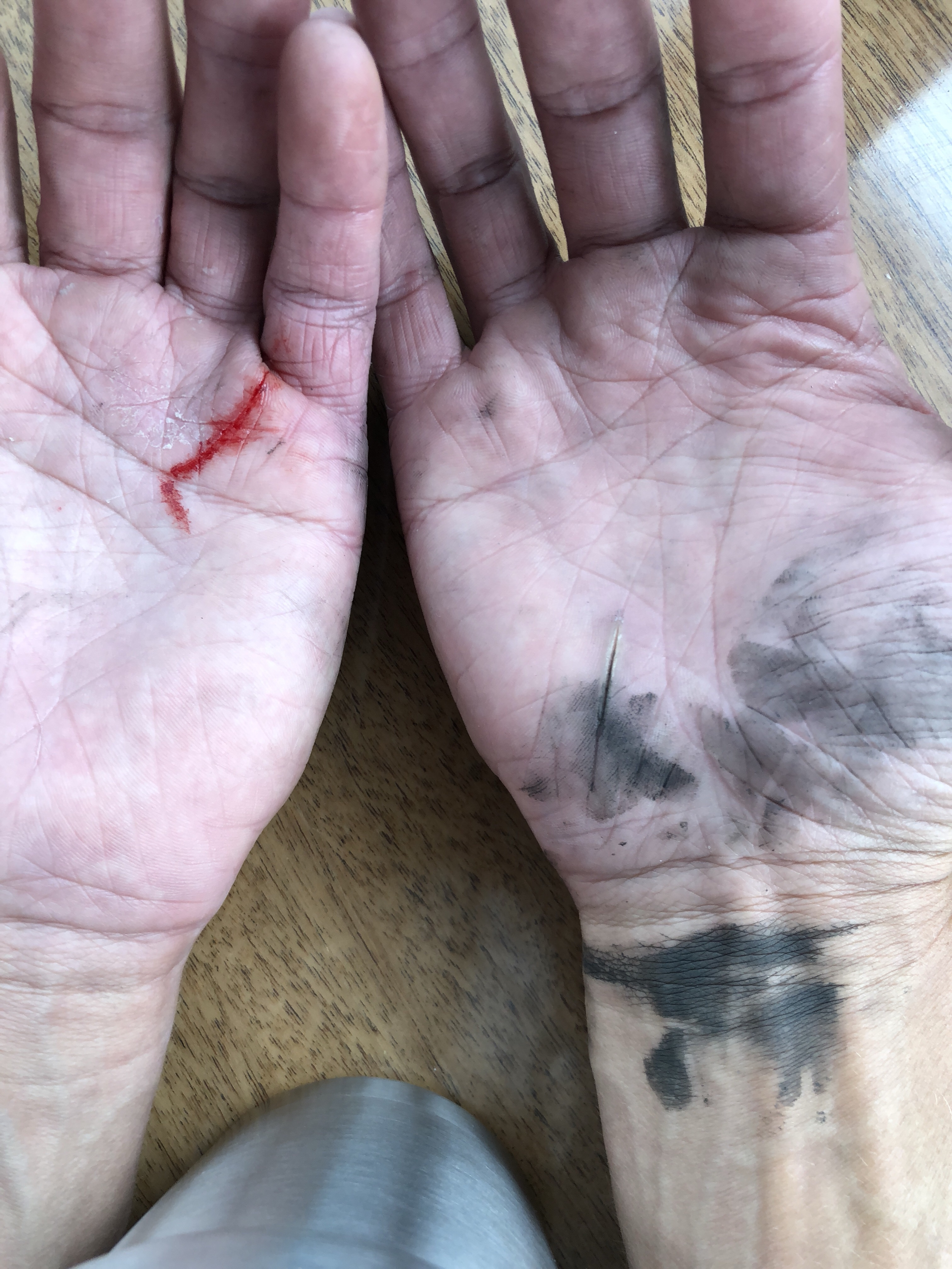 Photo of beat up hands